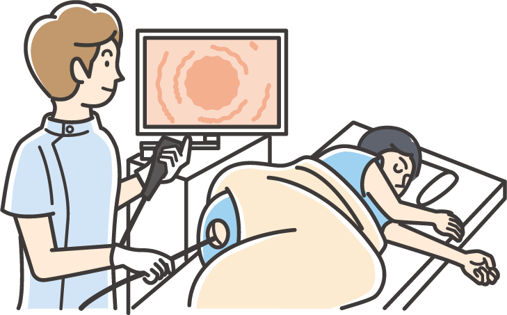 大腸検査を行っている様子